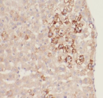FBXL14 Antibody