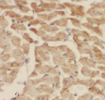 FBXO17 Antibody