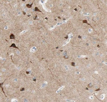FBXO2 Antibody
