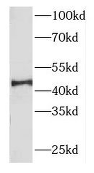 FBXO22 Antibody