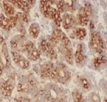 FBXO22 Antibody