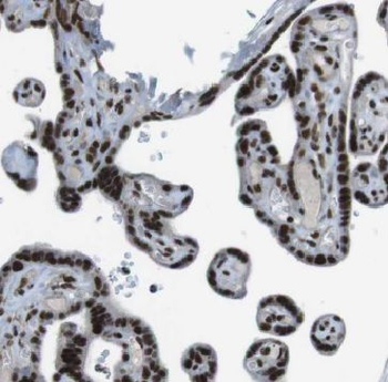 FBXO5 Antibody
