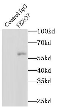 FBXO7 Antibody