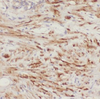FBXO7 Antibody