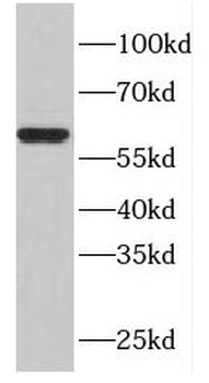 FBXW11 Antibody