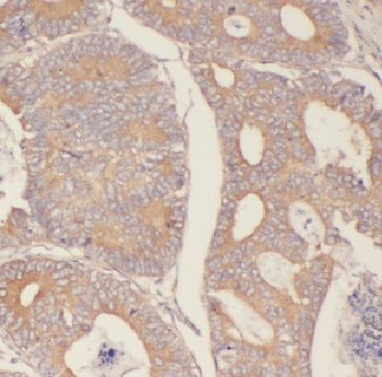 FBXW2 Antibody