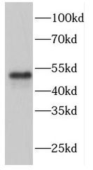 FBXW4 Antibody