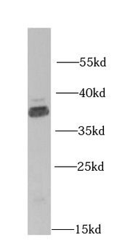FCN1 Antibody