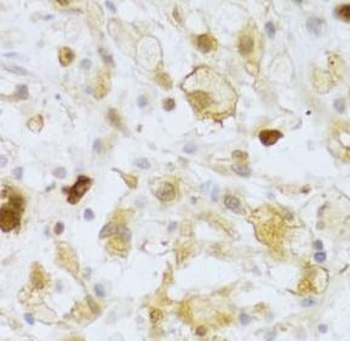 FCN1 Antibody