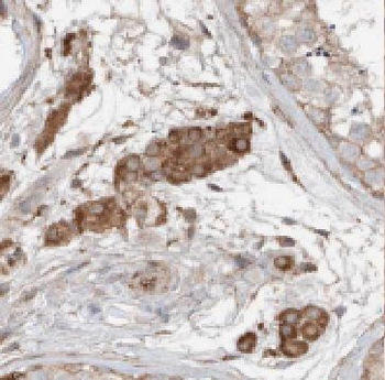 FDXACB1 Antibody