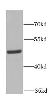 FECH Antibody