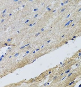 FECH Antibody