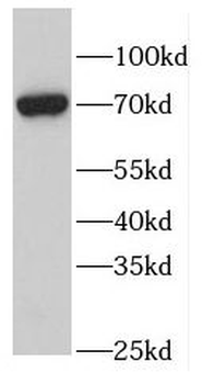 FEM1B Rabbit Polyclonal Antibody