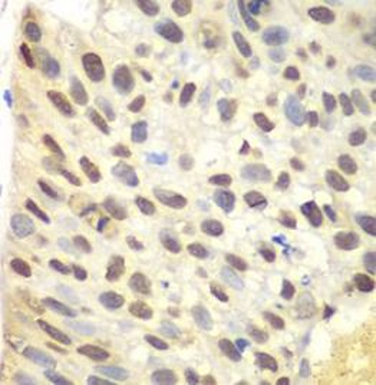 FEN1 Antibody