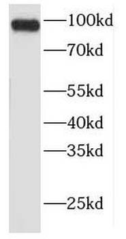 FER Rabbit Polyclonal Antibody