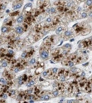AHSG Antibody