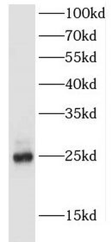 FEV Antibody