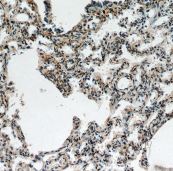 FGD5 Antibody