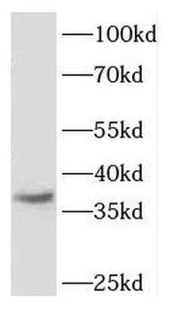 FGFBP2 Antibody