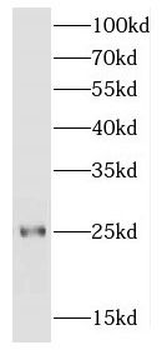 FGFR1OP2 Antibody