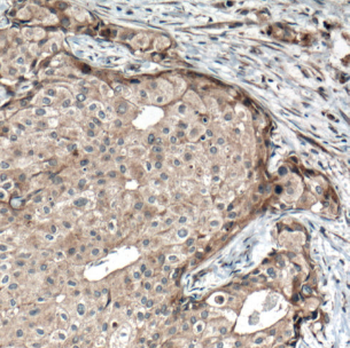 FGFR4 Antibody