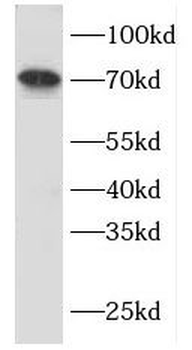 FGL2 Antibody