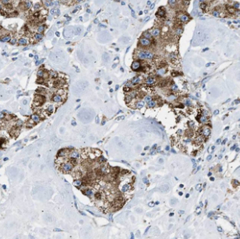FGL2 Antibody