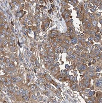 FH Antibody
