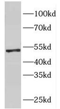 FH Rabbit Polyclonal Antibody
