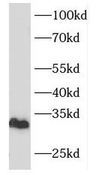 FHL1 Rabbit Polyclonal Antibody