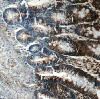 FIBCD1 Rabbit Polyclonal Antibody