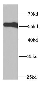 FGB Rabbit Polyclonal Antibody
