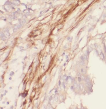 FN1 Mouse Monoclonal Antibody