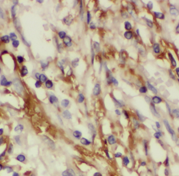 FBLN5 Antibody