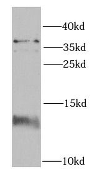 FKBP1A Rabbit Polyclonal Antibody