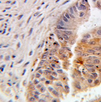 FKBP1A Rabbit Polyclonal Antibody