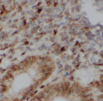 FKBP5 Antibody
