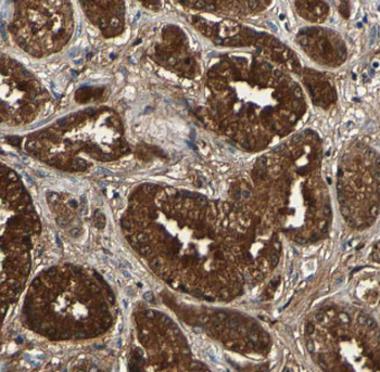FKBP4 Antibody