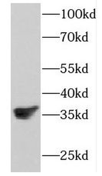 FKBP6 Antibody
