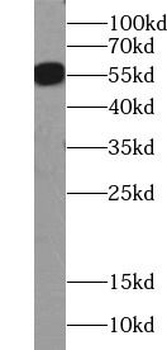 Flag tag Rabbit Polyclonal Antibody