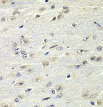 FMR1 Antibody