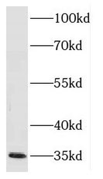 FN3K Antibody
