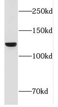 FNDC3A Rabbit Polyclonal Antibody