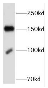 FNDC3B Antibody