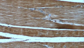 FNDC5 Antibody