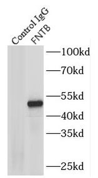 FNTB Antibody