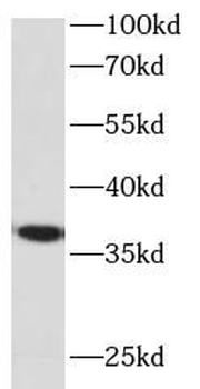 FST Rabbit Polyclonal Antibody