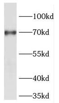 FOXC1 Rabbit Polyclonal Antibody