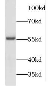 FOXC2 Rabbit Polyclonal Antibody