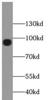 FOXO3 Rabbit Polyclonal Antibody